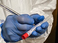 В РФ зарегистрировано более 120 тест-систем на выявление COVID-19 и антител