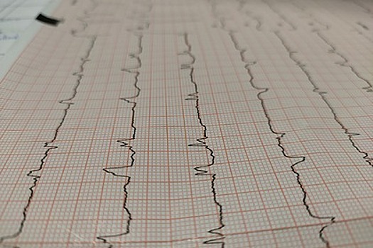 Кардиолог назвал причину покалываний в сердце у молодых людей