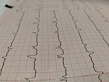 Кардиолог назвал причину покалываний в сердце у молодых людей