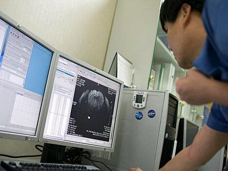 Ученые: тромбы в мозгу жертв инсульта не поздно удалять и через 16 часов