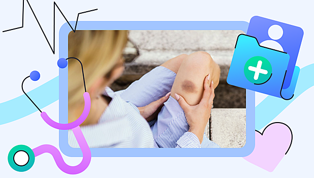 Гемофилия и ещё 4 редкие болезни, которые могут скрываться за синяками