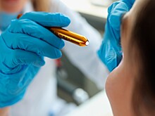 Врач назвал симптомы, с которыми нужно обратиться к неврологу