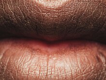 Привычку кусать губы назвали фактором риска развития редкой формы рака