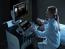 Искусственный интеллект научили находить врожденные болезни на данных УЗИ