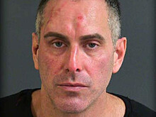 Пассажир откусил ухо соседу по креслу в самолете