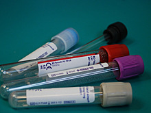 Врач указал на проблемы с кровью после «омикрона»