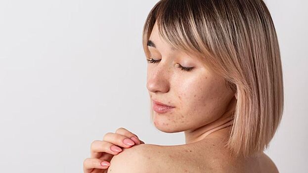 Косметолог Савина предупредила о негативном влиянии стресса на кожу