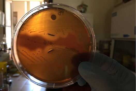 "Плотоядные бактерии" отравили жизнь 525 японцам