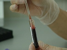 Врач объяснил пользу плазмы переболевших коронавирусом