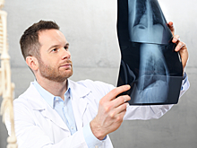 «Атомная бомба»: чем опасен COVID-19 при болезнях легких