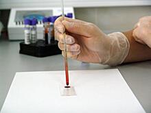 Российские ученые нашли новый способ борьбы с раком