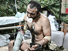 СКР рассказал, как украинские врачи намеренно калечат солдат ВС России