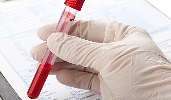 ...А сепсис может быть опаснее вируса