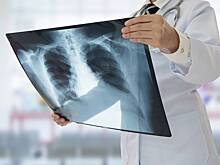 Обнаружена причина распространения устойчивого к лечению туберкулеза