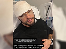 Звезда «Дома-2» сделал пластику у Хайдарова