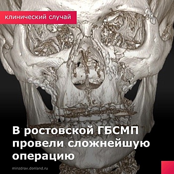 Установили восемь пластин: ростовские хирурги провели сложную операцию по восстановлению лицевых костей