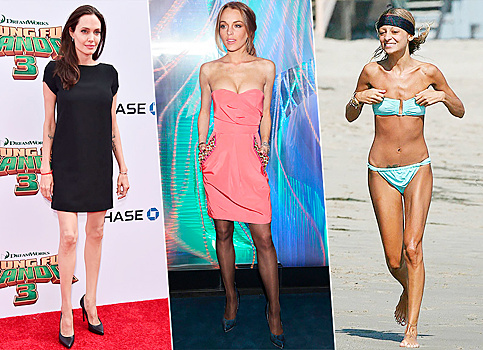 Леди Гага, Анджелина Джоли и другие звезды, которые победили анорексию и булимию