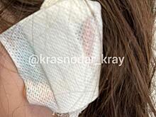 В Новороссийске разыскивают владельца собаки, покусавшей ребёнка