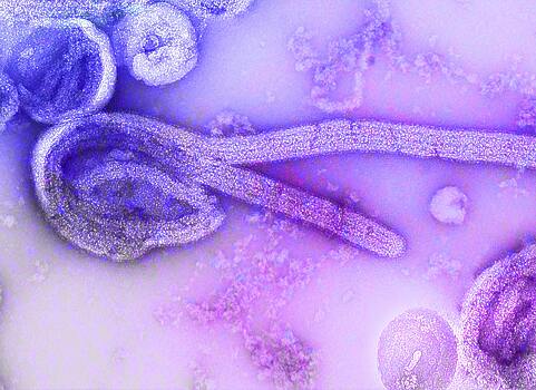 Вакцины и лечения нет: необычный штамм Эболы убил 23 человека