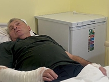 СК завел дело о теракте по факту ранения главы Беловского района Волобуева