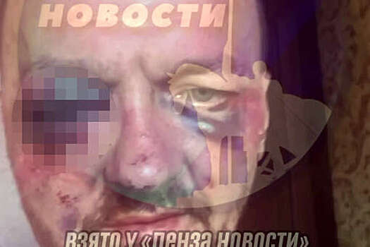 В Пензе безногий мужчина обвинил водителя скорой помощи в избиении