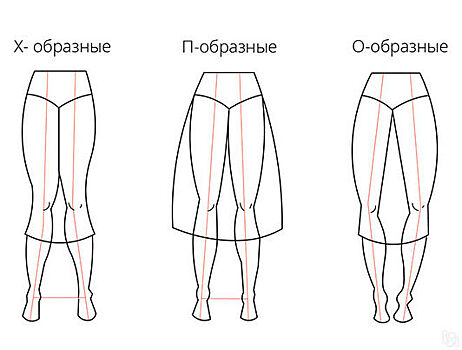 О, П или Х-образные: как определить свою форму ног и скрыть недостатки