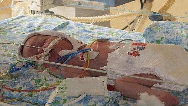 Воронежские врачи рассказали о состоянии новорождённой, найденной с мёртвой матерью