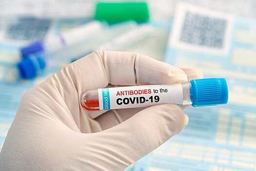 Антитела к коронавирусу SARS-CoV-2: хитрости диагностики