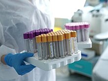 Попова назвала группу наиболее подверженных COVID-19 среди работников