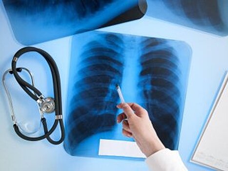 В Госдуме одобрили проект об обязательном лечении больных туберкулезом