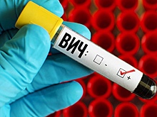 Вопрос профилактики ВИЧ включат в документ по охране труда