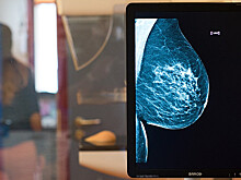 Смертность от рака возрастает на 85% при отсрочке терапии