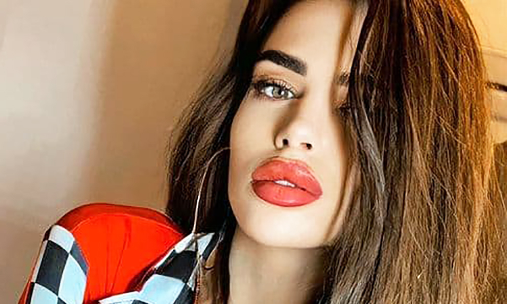 У экс-участницы «ДОМа-2» Анастасии Балинской провалился и загнил нос. Пластинка, которую ранее врачи вживили в кончик носа, сместилась.