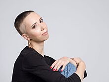 Жительницу Печатников сделало более уверенной редкое заболевание