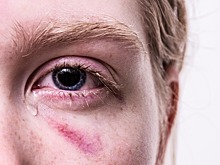 Мужчина травмировал подругу жены у неё же в гостях