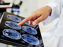 Что врачи делают каждый день для здоровья мозга