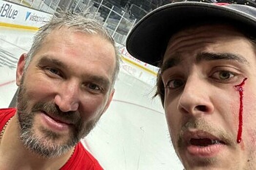 RMNB о «кровавом селфи» фаната с Овечкиным: рьяно спешил к Великой восьмерке