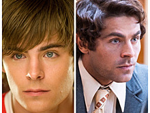 Звездные мужчины, которые не скрывают, что делали пластику