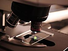 На Украине разработали тест-систему для выявления нового коронавируса