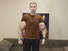 Кирилл «Руки-Базуки» показал последствия своих экспериментов с синтолом