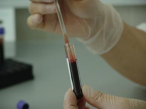 Может ли у человека измениться группа крови или резус-фактор