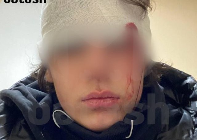 Житель Башкирии сломал школьнику глазницы и челюсть