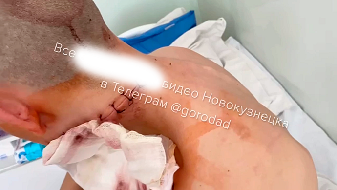 СК возбудил дело о покушении на убийство после нападения с мачете на юношу в Новокузнецке
