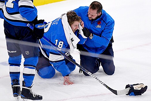Жуткая травма в НХЛ. Канадцу наложили 30 швов после попадания шайбы в голову