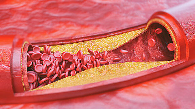 "Сосуды без тромбов": в России создано уникальное покрытие для стентов