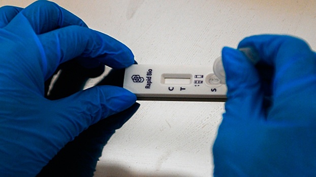 В России создадут тест-систему для выявления штамма коронавируса «омикрон»