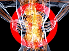 Нефролог назвала самый яркий симптом камней в почках