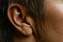 «Это предупреждение от организма»: врач назвал основные причины шума в ушах