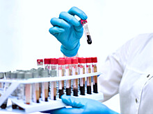 Россиянка Ологонова временно отстранена по подозрению в нарушении антидопинговых правил