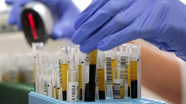 Что будет, если вы не долечите пневмонию до конца